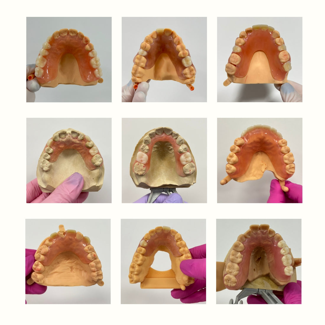 Types of Dentures Offered by Smile Lab USA: A Comprehensive Guide