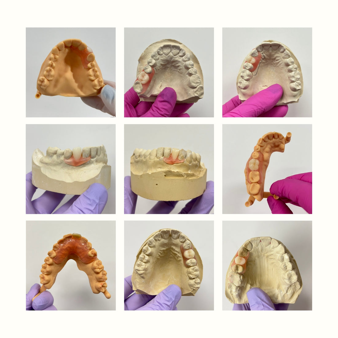 Cheapest Option for Missing Tooth: Affordable Solutions from Smile Lab USA