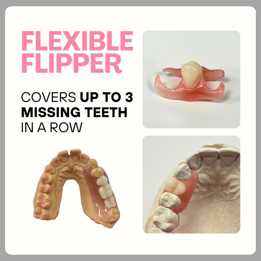 Everything You Need to Know About Replacing a Missing Tooth with Smile Lab USA