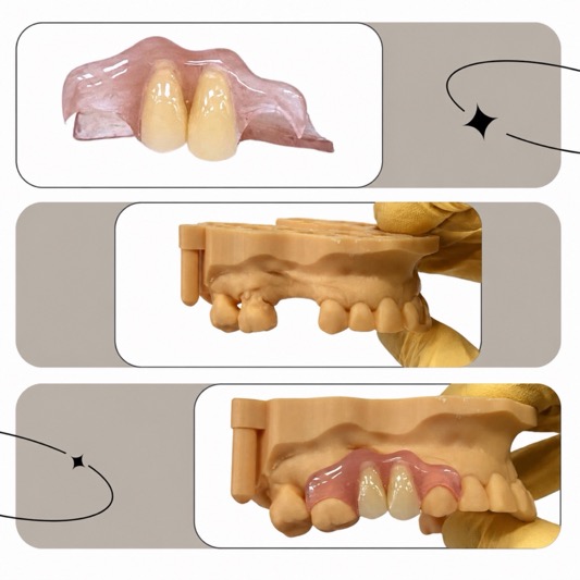 How Much Does a Flipper Tooth Cost? Explore the Differences Based on Location, Materials, and Complexity