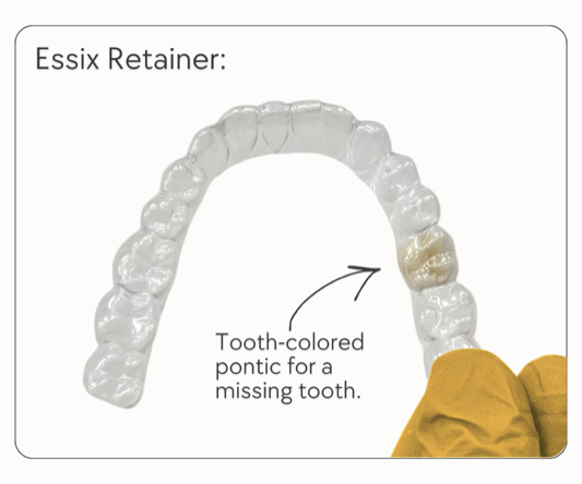 Essix Retainer
