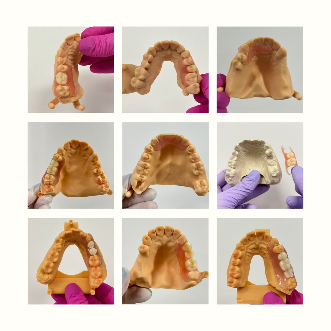 Exploring the Range of Affordable, At-Home Tooth Replacement Solutions with Smile Lab USA