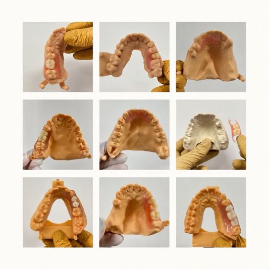 Discover the Excellence of Our Premium Dentures - Smile Lab USA
