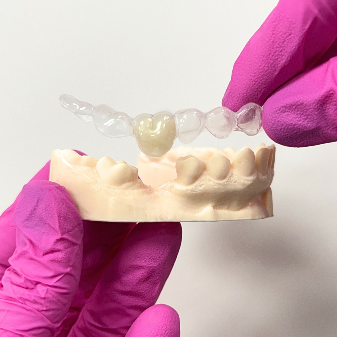 Comprehensive Guide to Recovery After Tooth Extraction: What to Expect and How to Heal Properly