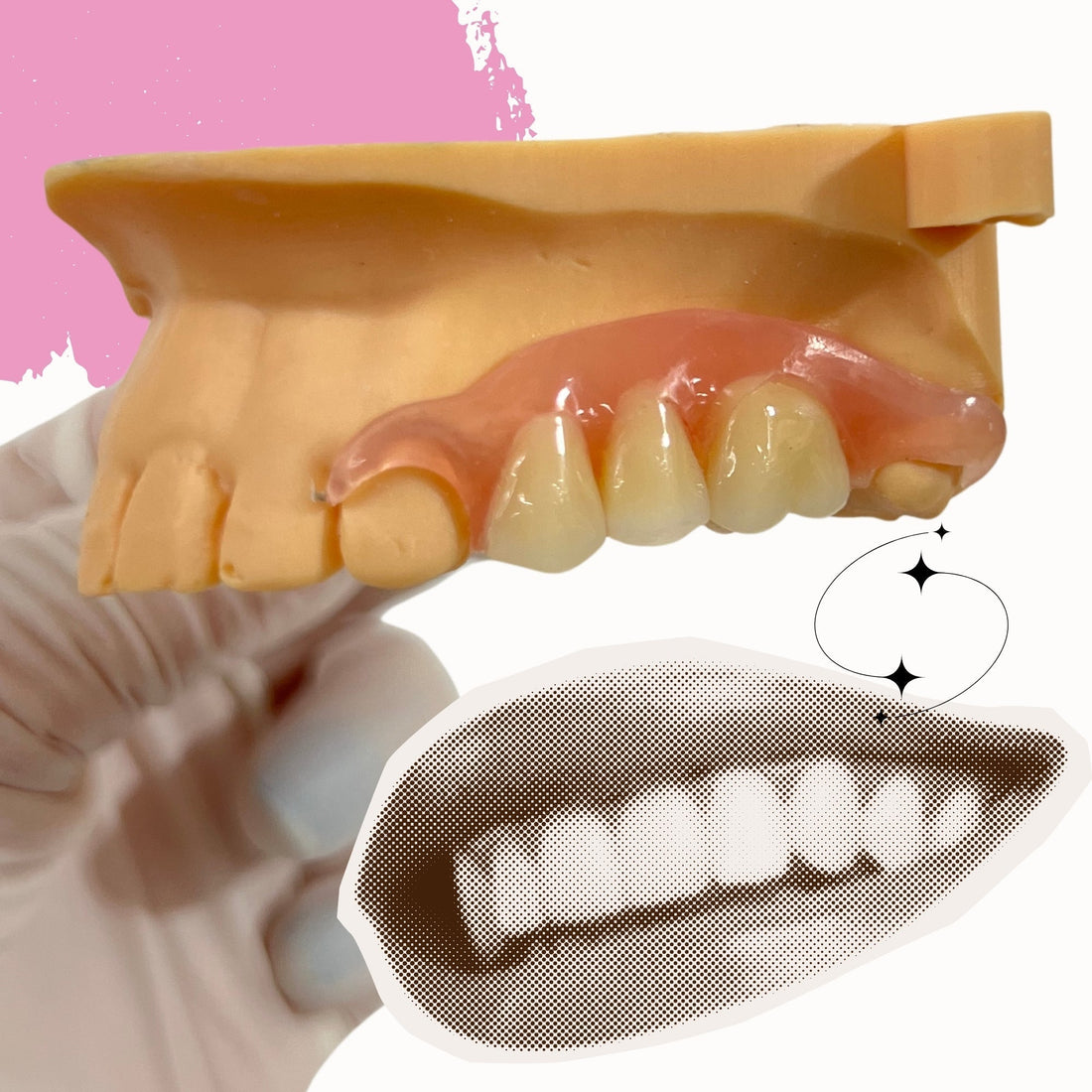 Nesbit Dental Appliance: Cost, Dental Code, Benefits & Alternatives for Missing Teeth