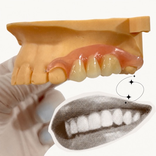 Nesbit Dental Appliance: Cost, Dental Code, Benefits & Alternatives for Missing Teeth