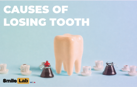 Causes of Losing Teeth