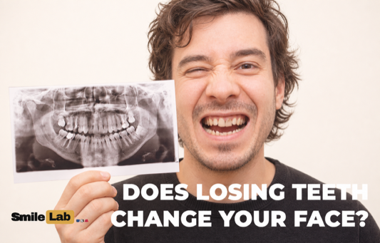 Man holding his dental X-ray, showing missing and treated teeth
