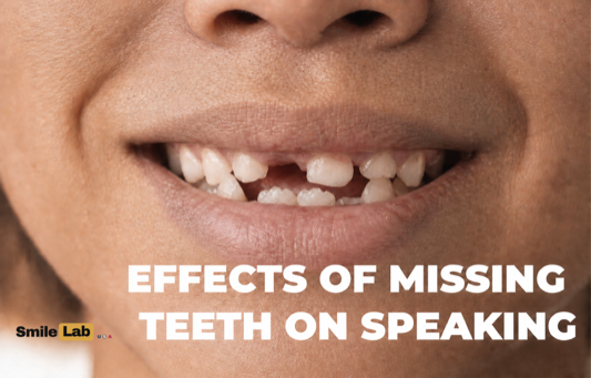 Close-up of a missing front tooth, one of the gaps that blurs speech