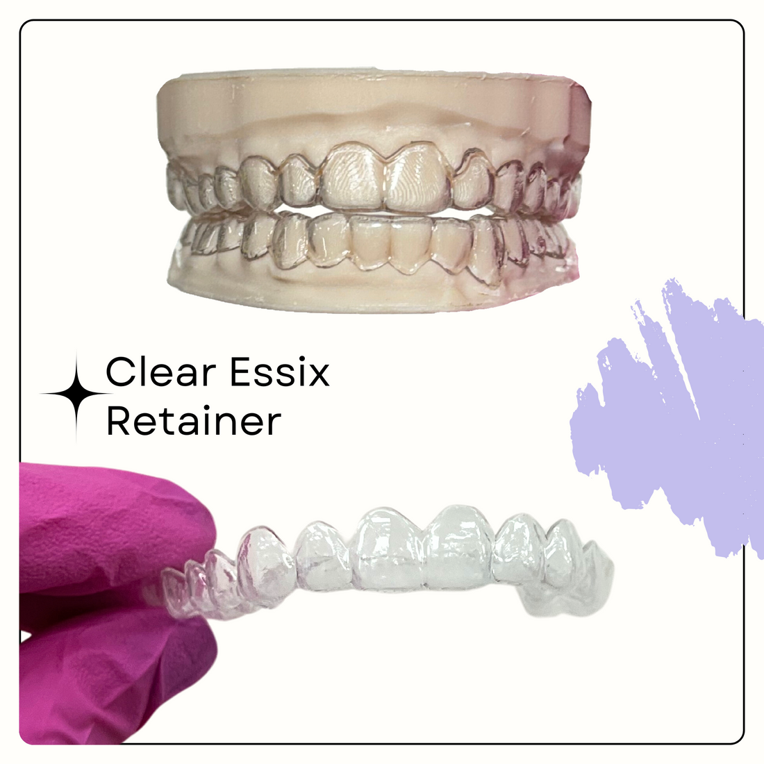 The Benefits of Clear Retainers: Why Essix Retainers Are a Game-Changer | Smile Lab USA