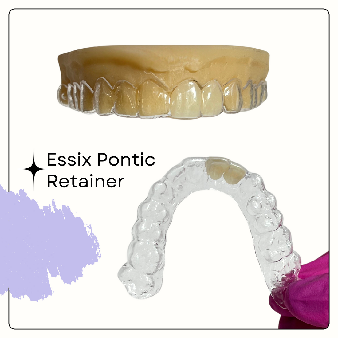 Essix Retainer vs. Dental Flipper: Which One Should You Choose?