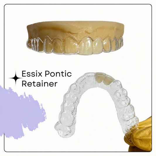 Essix Retainers: Your 2024 Guide to Clear & Pontic Retainers