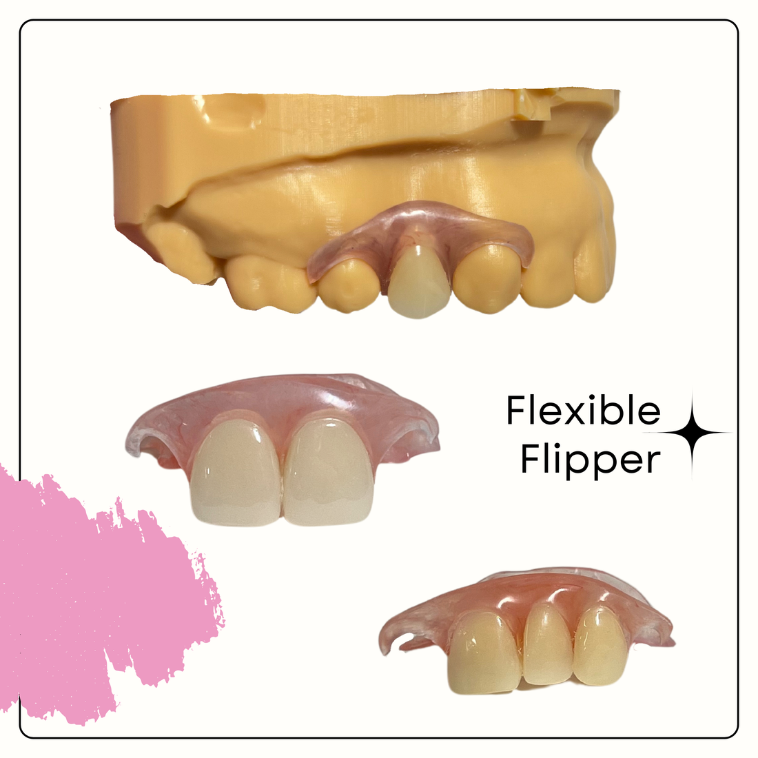 Flexible Flippers: The Affordable, Temporary Tooth Replacement Solution | Smile Lab USA