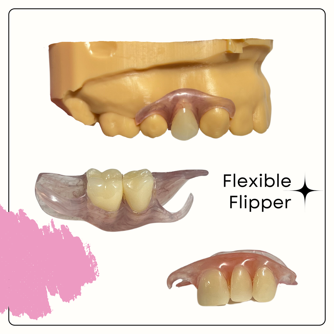 Flexible Flippers: Your Temporary Smile Solution in South Florida – Smile Lab USA