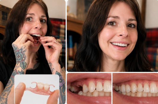 Missing back teeth before and after transformation showing a custom flexible partial denture restoring a complete smile, with close-up views of the removable dental appliance and real patient results.