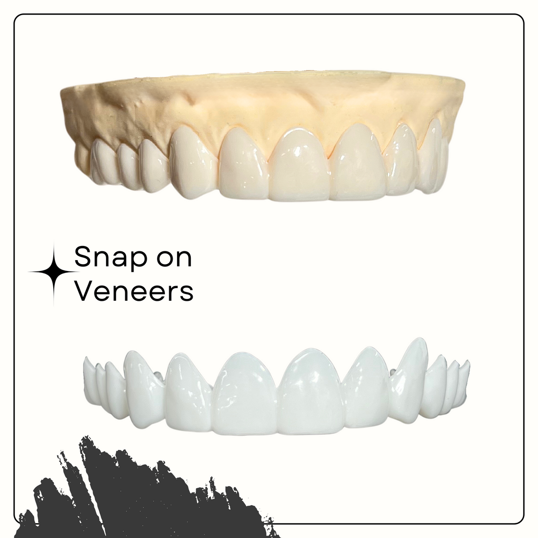 Achieve Your Dream Smile with Smile Lab USA's Easy Smile Snap-On Veneers