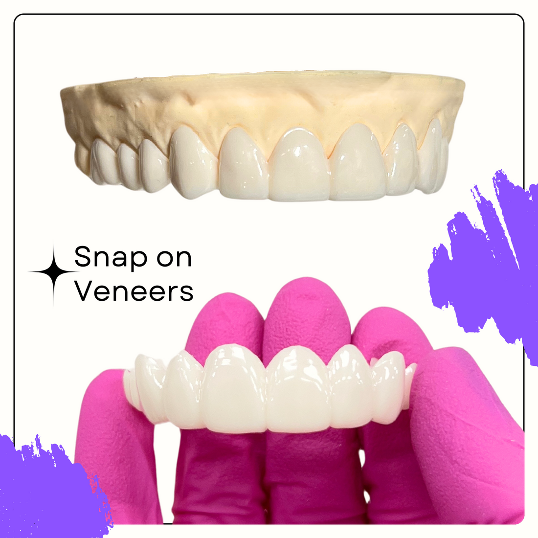 Why Snap-On Veneers Are the Perfect Solution for a Confident Smile