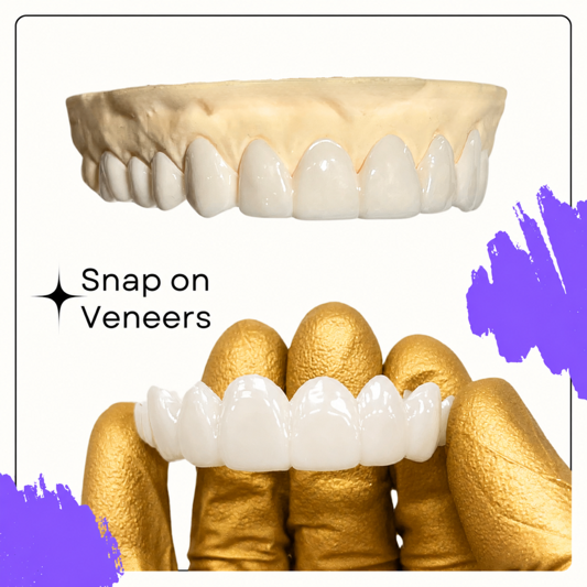 Why Snap-On Veneers Are the Perfect Solution for a Confident Smile