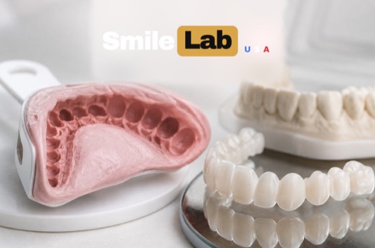 Dental teeth impression mold next to snap-on veneers with Smile Lab USA logo, showing why accurate teeth impressions matter for custom veneer fit and comfort.