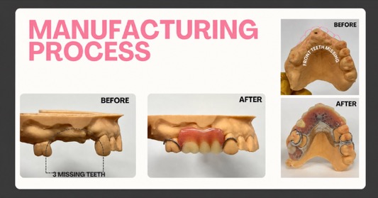 Manufacturing Process - Smile Lab USA