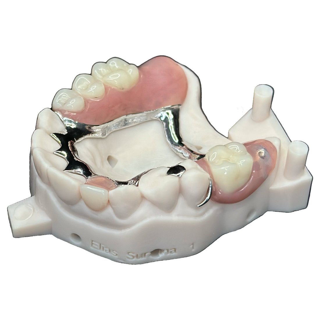 What is a Metal Framework Denture?