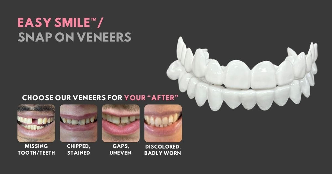 Transform Your Smile with Smile Lab USA: The Best At-Home Veneer Kits - Smile Lab USA