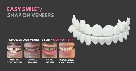 Transform Your Smile with Smile Lab USA: The Best At-Home Veneer Kits - Smile Lab USA