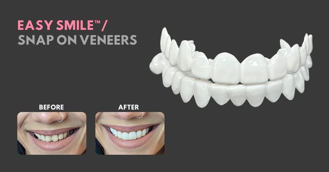 Welcome to Smile Lab USA: The Home of Easy Smile Snap-On Veneers - Smile Lab USA