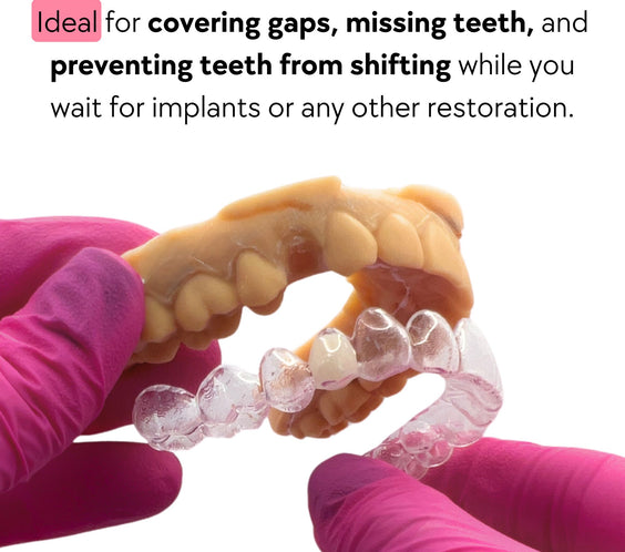 prevent teeth from shifting