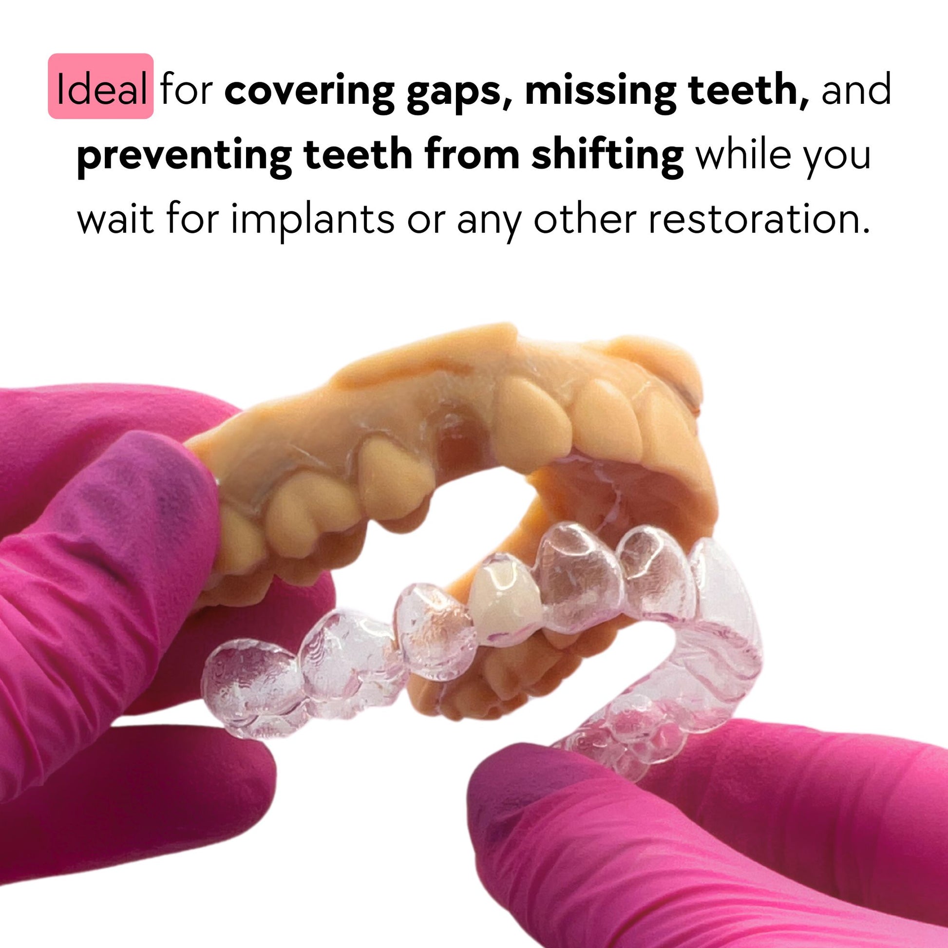 prevent teeth from shifting