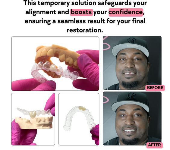 Before and after images of a person using essix retainer