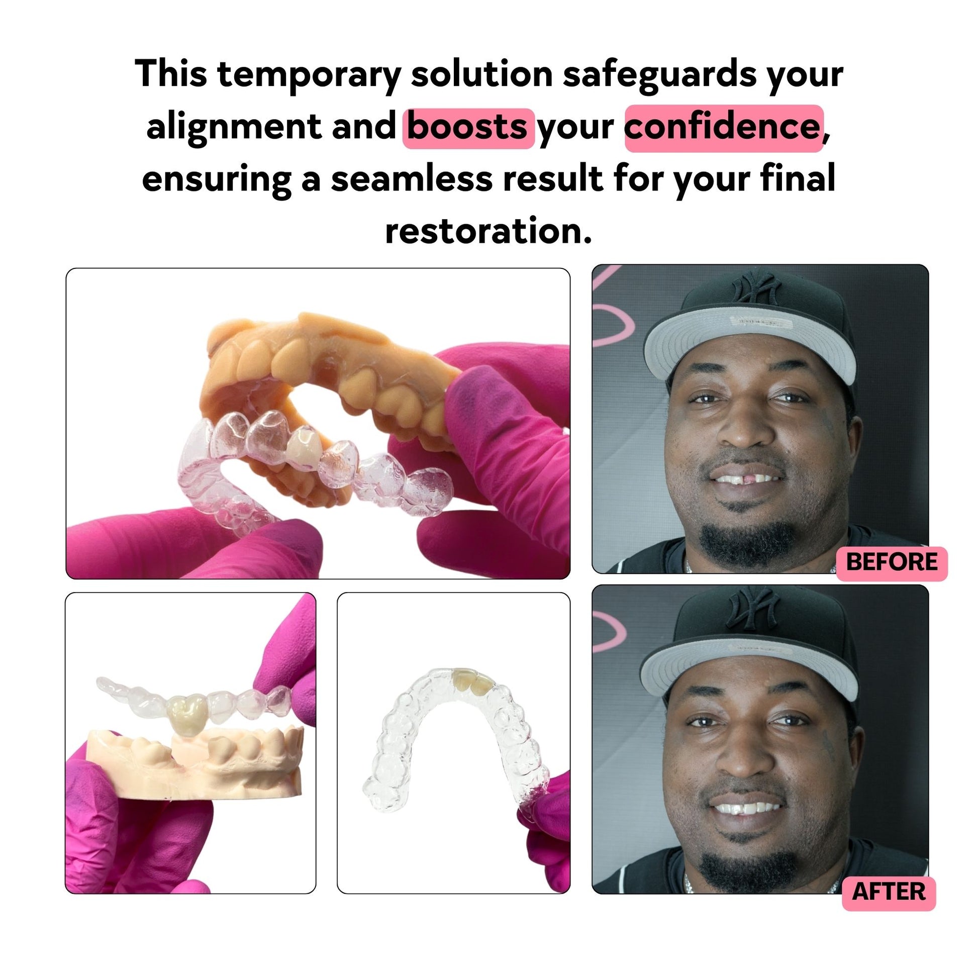 Before and after images of a person using essix retainer