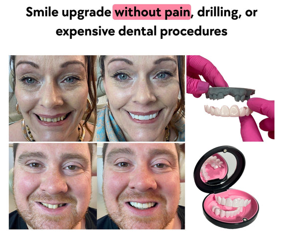 Before And After Results  Snap-on Veneers