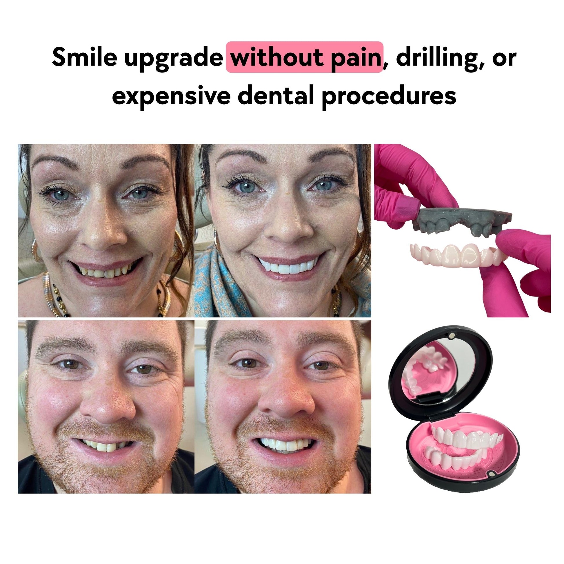 Before And After Results  Snap-on Veneers