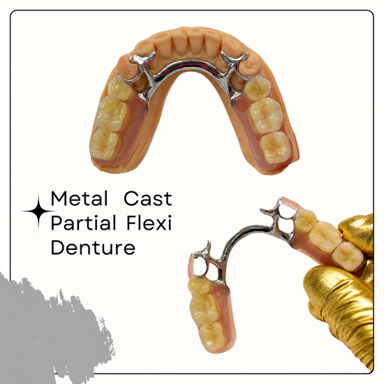 Cast metal partial denture with a chrome framework