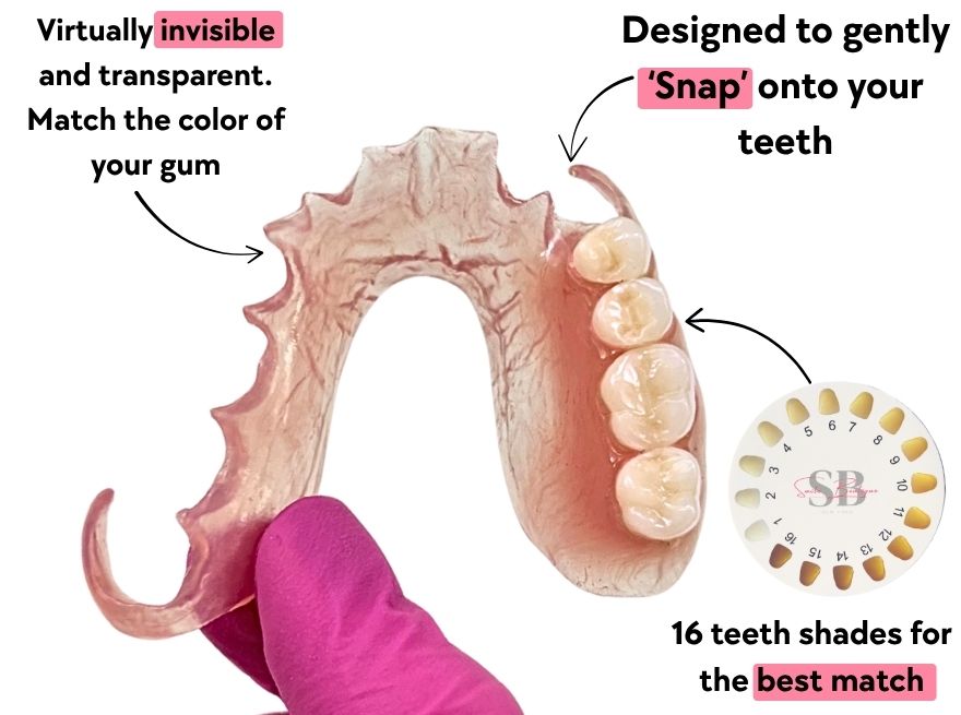 Partial denture