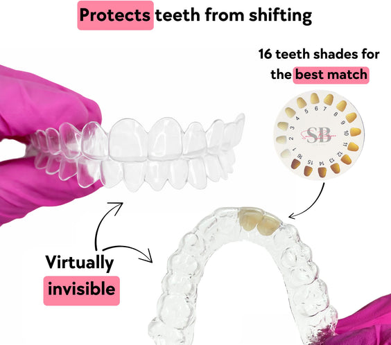 Clear and pontic dental aligners 