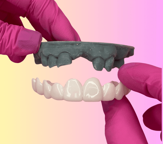 Snap-On Veneers Smile Lab USA