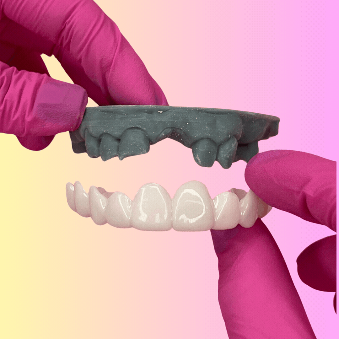Snap-On Veneers Smile Lab USA