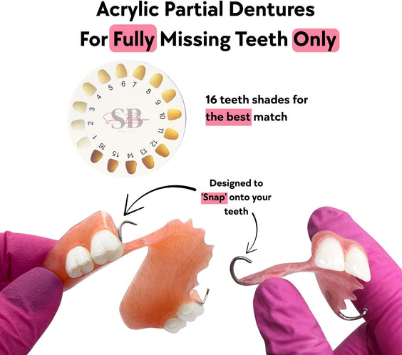 Acrylic Partial Dentures