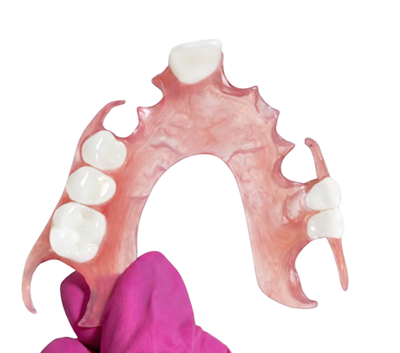 Flexi Partial Dentures