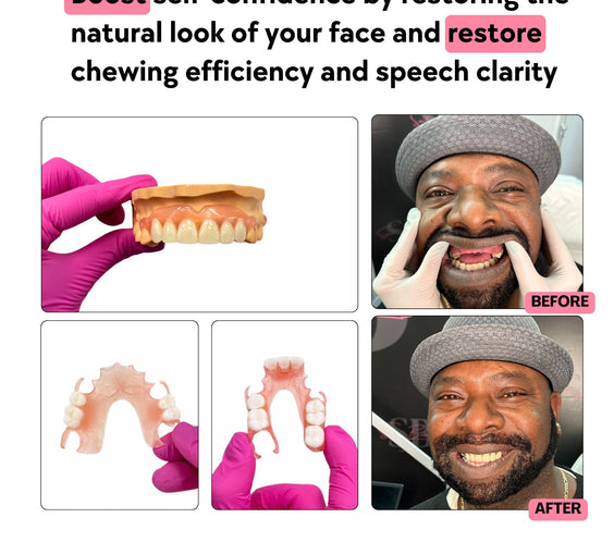 flexible_partial_denture_for_up_to_8_missing_teeth