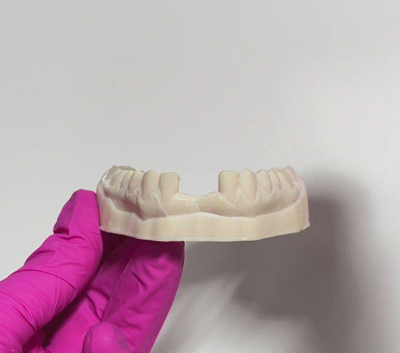 lower pontic essix retainer on the dental model