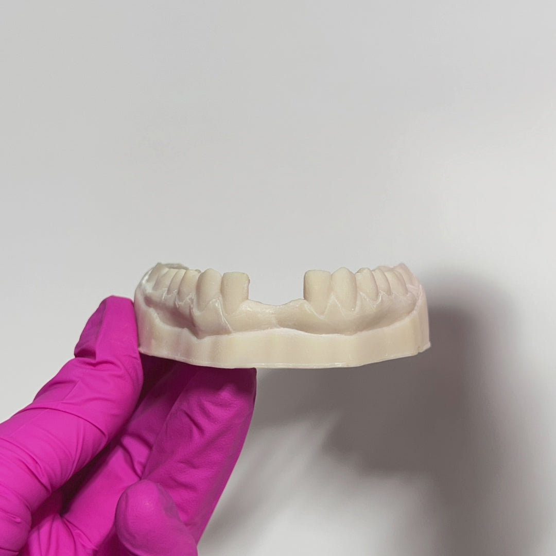 lower pontic essix retainer on the dental model
