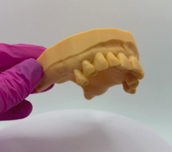 Acrylic Partial Denture Upper