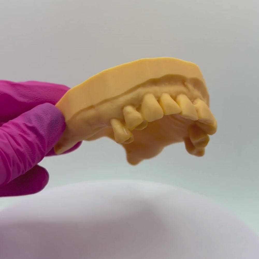 Acrylic Partial Denture Upper