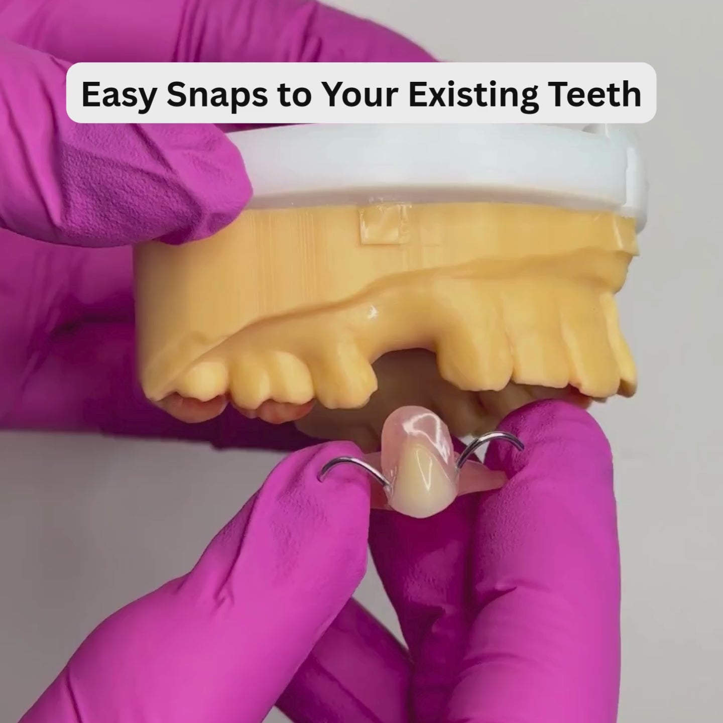 Acrylic flipper snaps easily to your existing teeth
