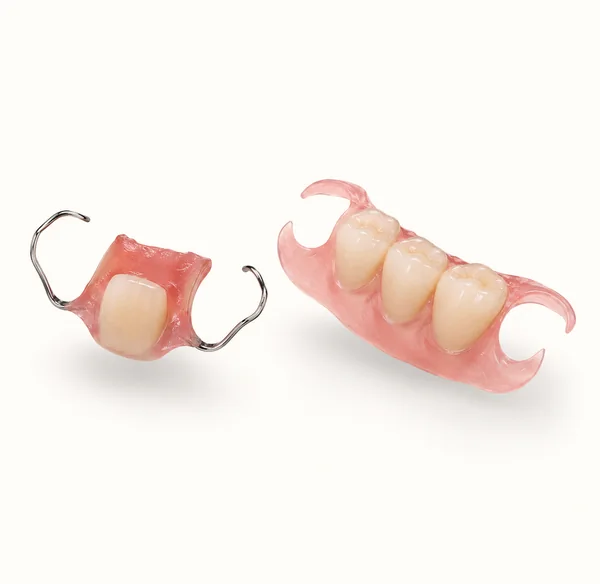 Upgrade to partial denture
