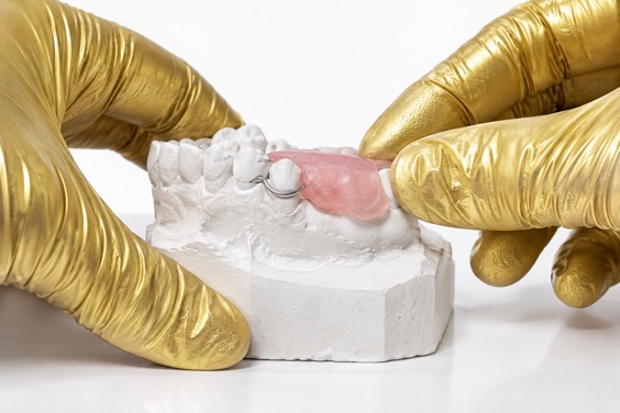 Acrylic flipper clasped onto the side teeth of a stone model
