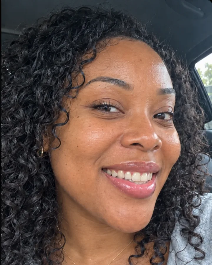 The same smile with a partial denture in place